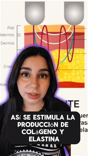 Radiofrecuencia Facial