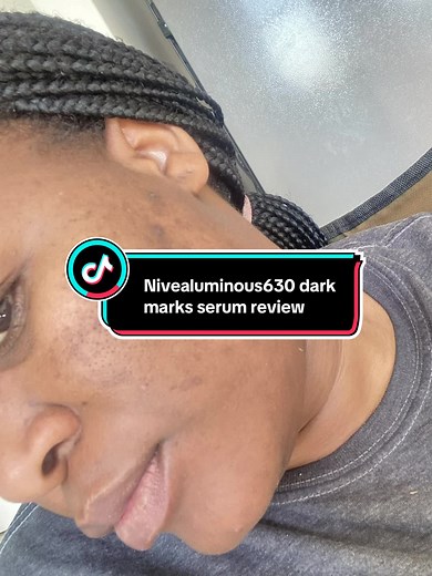 Get Brighter and Glowing Skin with Nivea Luminous 630 Serum