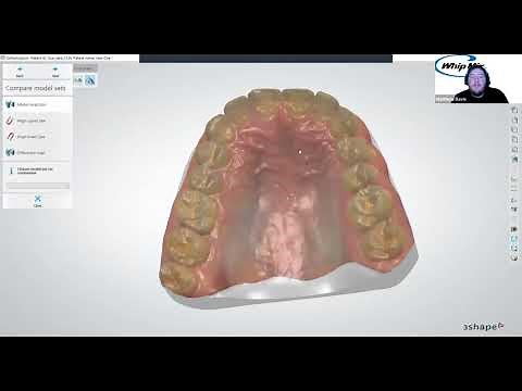 [Webinar] 3Shape Aligner Studio with Ortho Analyzer with Matthew Davis