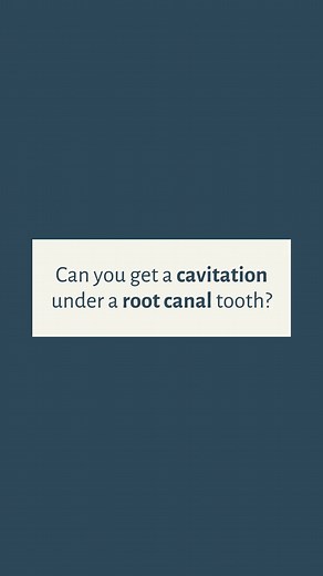 Can you get a cavitation under a root canal tooth? Watch and find out. Want to know what a cavitation is? Bone that didn't heal (typically after tooth removal) This is EXTREMELY common. Most people when they hear cavitation, they think of a cavity. They are very different. a lot of people have cavitations and don't even know it. Pain in the jaw, random symptoms after tooth removal... There are some things that can happen when you have a cavitation. Curious if you have one? Get a cone beam ct sca
