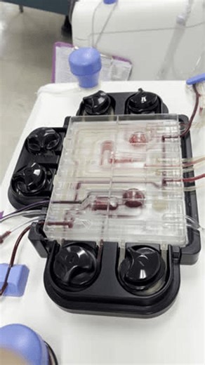 clip-3975322611-platelet-plateletpheresis-procedure-separate-platelets ...