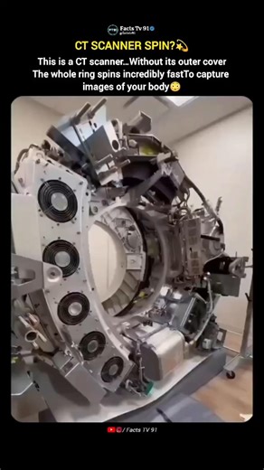 Inside a CT Scanner at Full Speed 😳