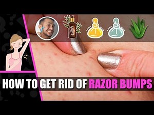 Razor bumps - How to get rid of razor bumps - Get rid of razor burns