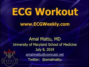 Benign early repol vs. STEMI