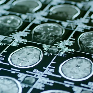 New frontiers in neuroscience: 10 years of progress at UTSW’s O’Donnell Brain Institute