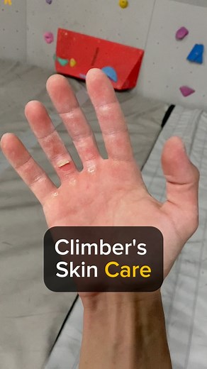 Alex Voit on Instagram: "Climber’s Skin Care – What Actually Works🧗‍♀️ You know that feeling — raw fingertips, painful to grab holds, and climbing stops being fun. So, how do you make your skin last longer and heal faster? Let’s go over the basics: 1. Dry hands = better grip. Use chalk and dry off between attempts. 2. Wash your hands after climbing. Dirty skin takes longer to heal. 3. Use healing balms or creams at night to speed up recovery. 4. File down thick skin — it prevents flappers and d