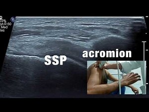 TMT: MSK USG Shoulder by Dr Mohit Shah (Part II)