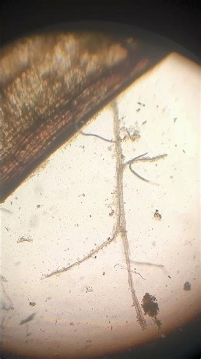 Spirostomum taking a walk #microscope #aquaticpets #micrologix #tinyworld #microbiology #spirostomum