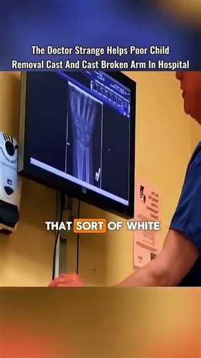 Part 2 The Doctor Strange Help Special Girl Removal Cast And Cast Broken Hand In Hospital 😳 #removal