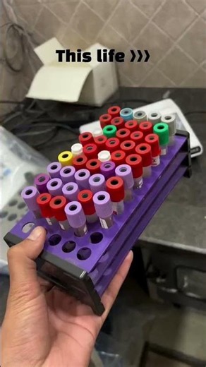 🔬 CBC Machine Working Process | Lab Life Diaries 🩸⚕️