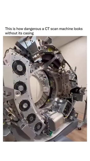 Detailed Explanation on Instagram: "Follow @detailedexplanation to learn something new every day! 🧠 Without its casing, a CT scan machine appears hazardous due to exposed high-voltage components, intricate internal mechanisms, potential radiation hazards, sharp edges, and moving parts. Its industrial look is much more intimidating compared to its usual smooth, sleek design. (Via: @arch_.irani)"