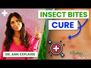Insect Bites: Treatment, Home Remedies & When to See a Doctor (Doctor Explains)