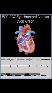 13K views · 269 reactions |  Hear the Rhythm: ECG-PCG + Real Heart...