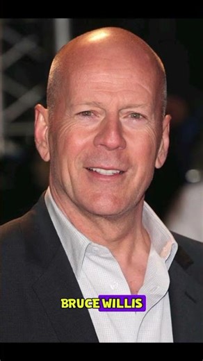 Bald Actors Before Losing Their Hair 😳 (Wait Till The Last One!)