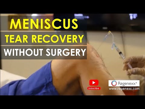 Meniscus Tear Recovery Without Surgery - Martin Fuentes - Regenexx