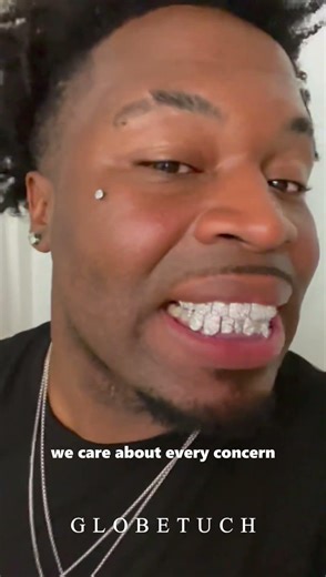 worry the grillz fall out？ #customgrillz #grillzreview