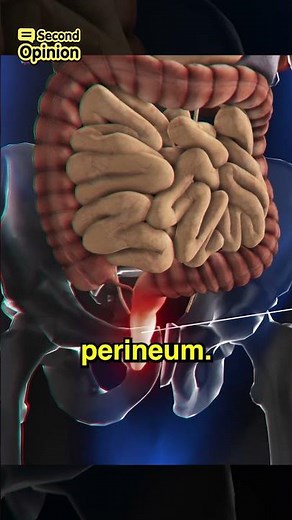 🚨 Cauda Equina Syndrome 🚨 Watch full video now ‪@MedTalkSG‬