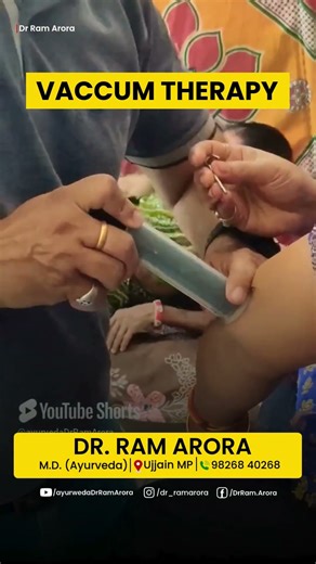 What Is Vacuum Therapy? Benefits, Uses, and Science by Dr. Ram Arora