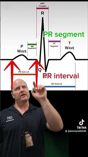 ECG basics- what is the difference between the PR interval and the PR segment? #ecg