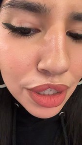 I have cleft lip & palate 💋 | Indigenous_baddie