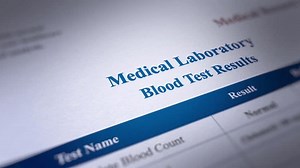 Animated Medical Laboratory Blood Tests Fictitious Stock Footage Video (100% Royalty-free) 3422864497 | Shutterstock