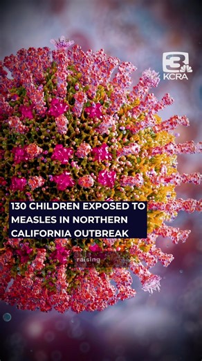 Measles cases up to six in Sacramento region, 26 overall in the state, as CA officials urge vaccination. #measles #health #norcal @KCRA3
