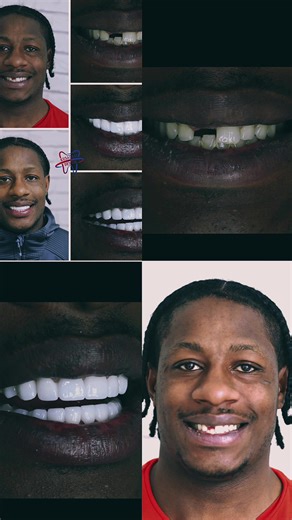 Personalized Smile Design Treatment for Natural Results