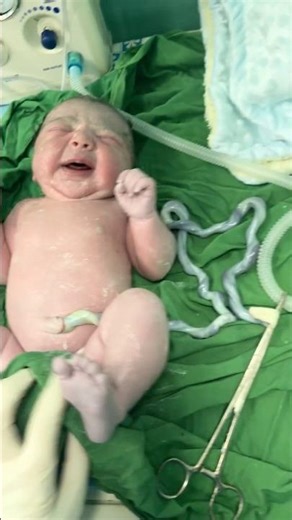 بند ناف قلبی‌شکل نوزاد👶❤️ | لحظه خاص بعد ازتولد#المولود#midwife#baby#heart#shorts#نینی#umbilical#حب