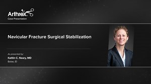 Navicular Fracture Surgical Stabilization