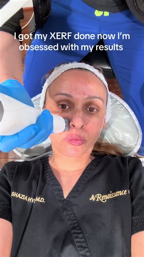 XERF Skin Tightening: Achieve Firmer Skin