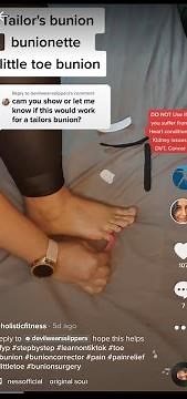 Tailor's bunion bunionette pinkie bunion little toe bunion kinesiology taping KT Tape Rocktape