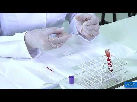 Blood Smear Technique