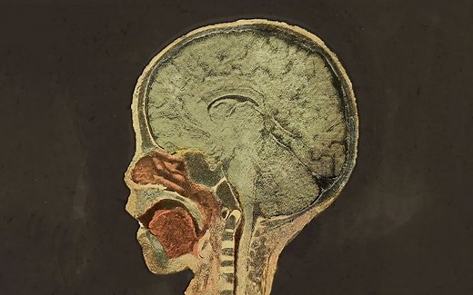 一个小孩啃下了他玩具上的含铅油漆，这是他的大脑发生的变化