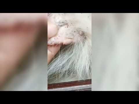 Satisfying Pimple Popping & Cyst Extractions - 150