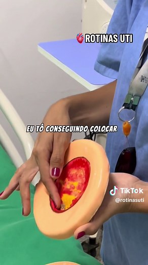 Qual LPP mais prevalente onde vocês trabanham? 😷 #enfermagem #lpp #curativo #utiadulto #medicina #rotinasuti