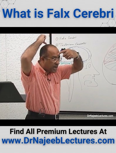 What Is Falx Cerebri. Falx cerebri is defined as a sickle-shaped vertical fold of dura mater that separates the two cerebral hemispheres and helps in preventing certain types of brain herniation. | Dr. Najeeb