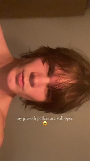 lip area holding me back, im almost a year into structural bone changes (got 1-2more years of open pallet) w late bloomer #chadlite #lookism #fyp #eyes #bones