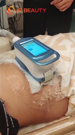 Safe & effective cryolipolysis for body sculpting.