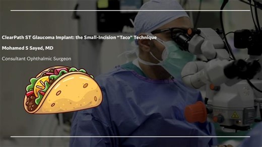 ClearPath ST Glaucoma Implant: The Small Incision “Taco” Technique | Ahmed Basha