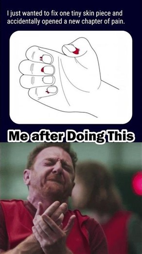 Use this sound #shorts #funny #memes