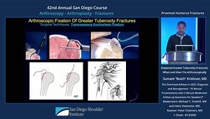 Arthroscopic Fixation of Gerater Tuberosity Fractures: When and How to Do It