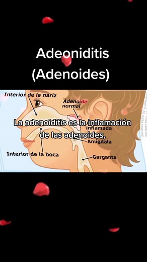 HerbaxGuatemala on TikTok