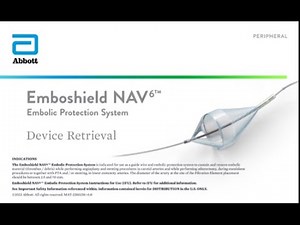 Device Retrieval | Emboshield NAV6™ Embolic Protection System