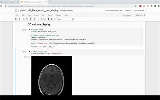 3D Slicer 可以与 Jupyter Notebooks 集成，以促进交互式数据探索、分析和可视化。