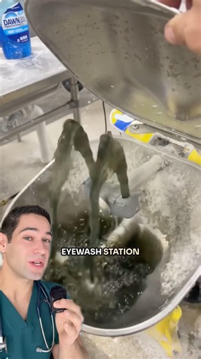 What happens if you get chemicals in your eyes?!