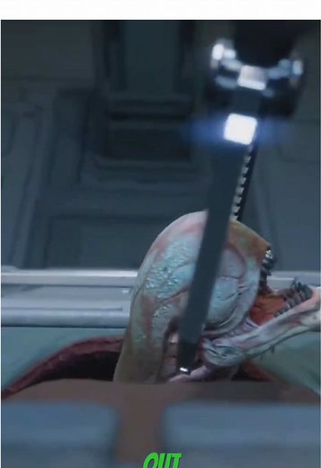 Removing the Baby Alien from Zula Hendricks' Body