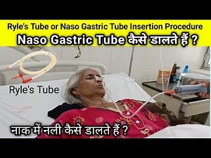 Ryles Tube or Naso gastric Tube insertion procedure Ryle's Tube कैसे डालते हैं nasogastric Tube कैसे