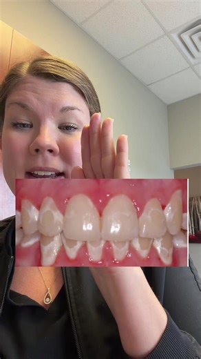 Effective Tool for Maintaining Oral Hygiene with Braces