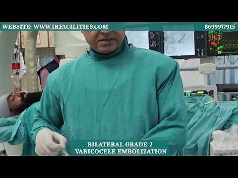 Bilateral Grade 2 Varicocele Embolization Explained | Full Procedure & Recovery | IRFACILITIES