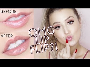 Botox Lip Flip VS Lip Filler